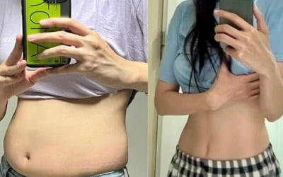 '♥김태현' 미자, 접히던 뱃살 어디 갔나…독한 다이어트 성공 "80kg에서 40kg 대까지"