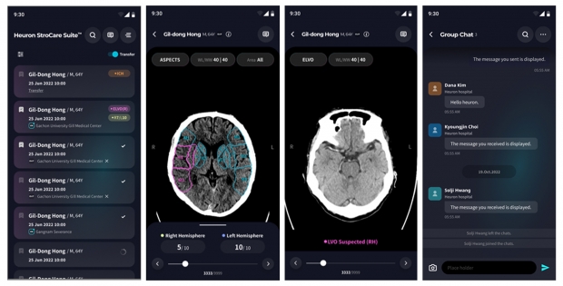 ‘1초라도 더 빨리‘ 휴런, 뇌졸중 선별 AI 모바일앱 출시