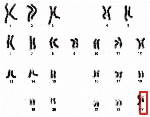 인간은 23쌍의 염색체를 갖고 있다. 이 중 한 쌍은 성을 결정하는 성염색체다. 여성은 XX, 남성은 XY로 표현된다. /위키미디어
 