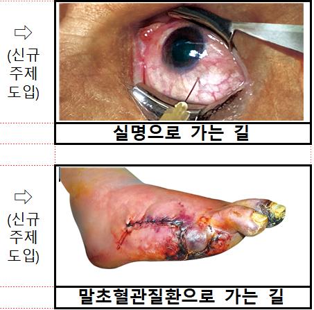 "흡연은 실명·말초혈관질환으로 가는 길"…담뱃갑 새 경고그림