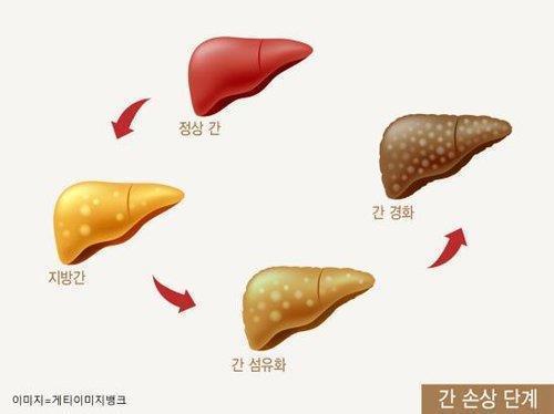 [사이테크+] "노화·스트레스로 인한 간 손상 회복 가능…생쥐실험 성공"