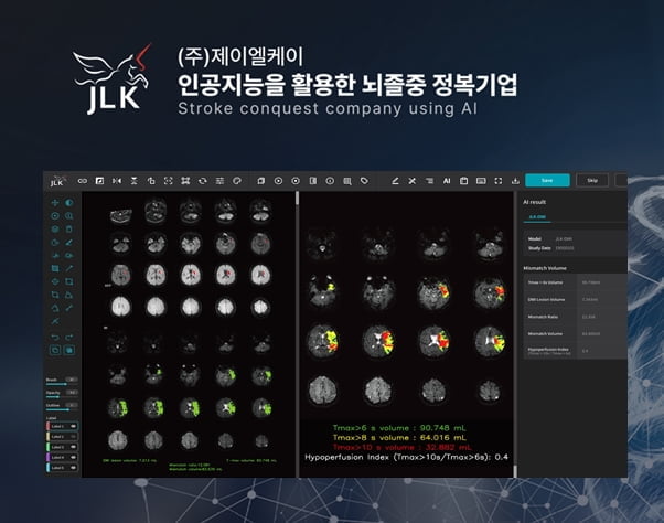 제이엘케이, KSEM 2024 참가…'뇌졸중 풀 솔루션' AI 기술력 공개