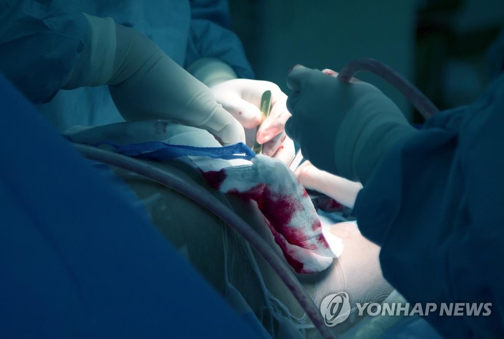 '분만시 무통주사·페인버스터 병행금지'에 반발…정부 재검토