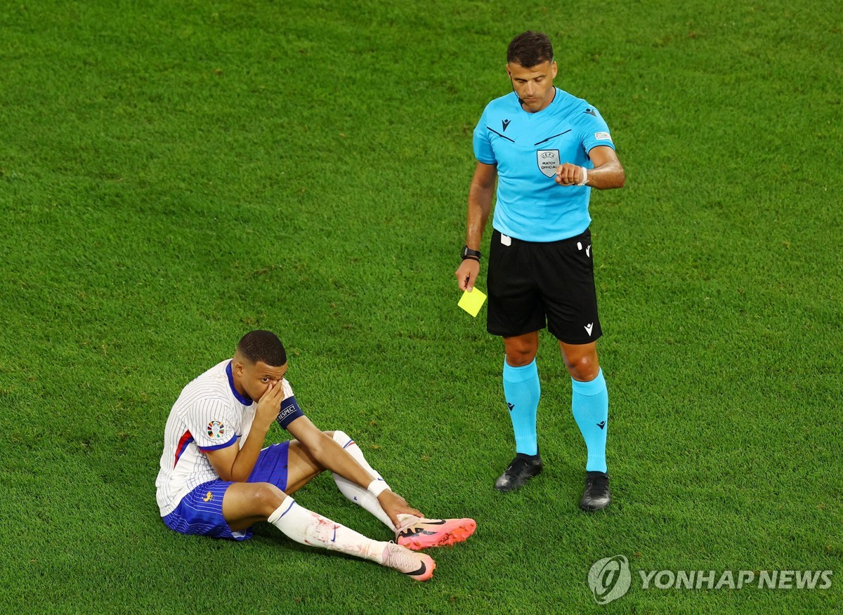 프랑스축구협회장 "음바페, 코 수술은 피해…네덜란드전 불투명"