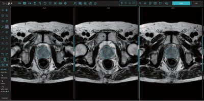 제이엘케이, 전립선암 AI진단 솔루션 국내 특허 획득