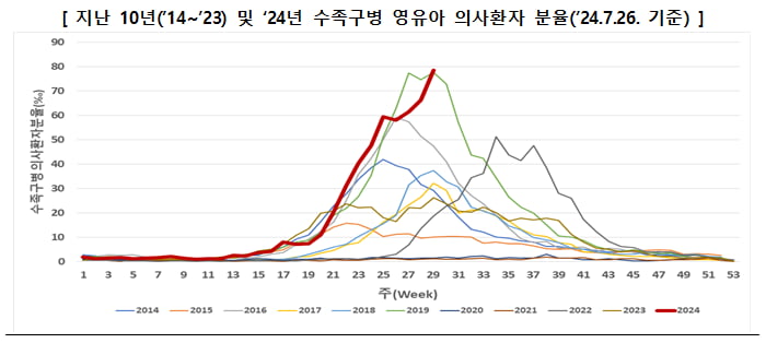 수족구병