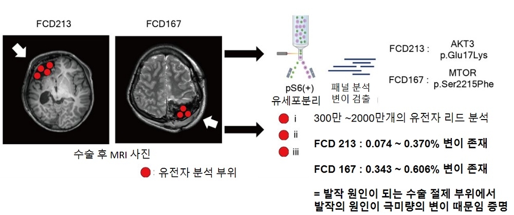 0.07% 돌연변이 세포로도 뇌전증 유발…KAIST 치료제 연구