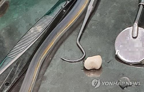 환자 얼굴에 핀셋 떨어뜨려 각막 손상…치과 위생사 유죄