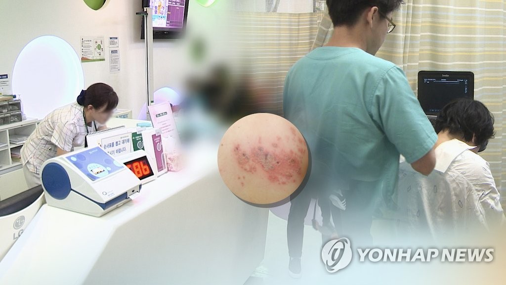 "대상포진 재조합 백신, 생백신보다 치매 예방 효과 더 크다"