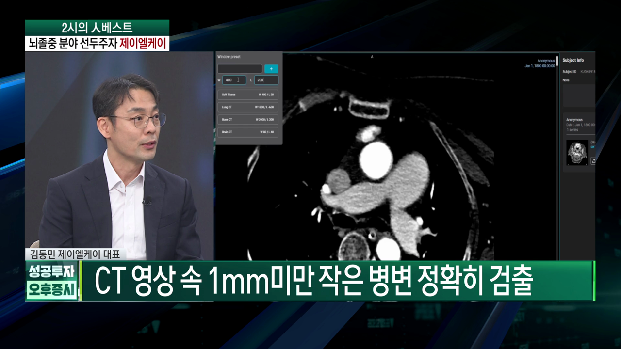 제이엘케이 대표 "뇌졸중AI, 국내보다 美서 반응 뜨거워"