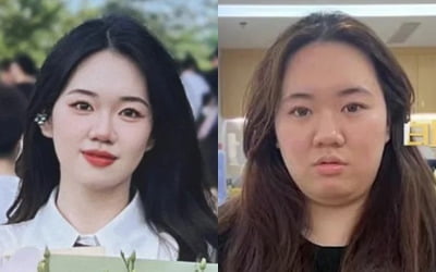 "이게 다 회사 때문이야"…입사 1년 만에 20kg 증가한 여성