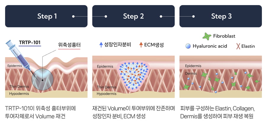 TRTP-101(카지노 양상수) 피부재생 작용기전. 셀인셀즈 제공