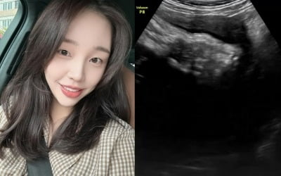 Baek A-yeon is about to give birth