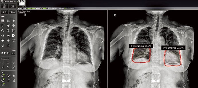 The AI ​​medical base is stirring again… When to pay attention to performance