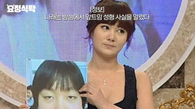 박나래, 성형 고백 "24살 때 앞트임 수술…애매하게 고쳤다"('요정재형')