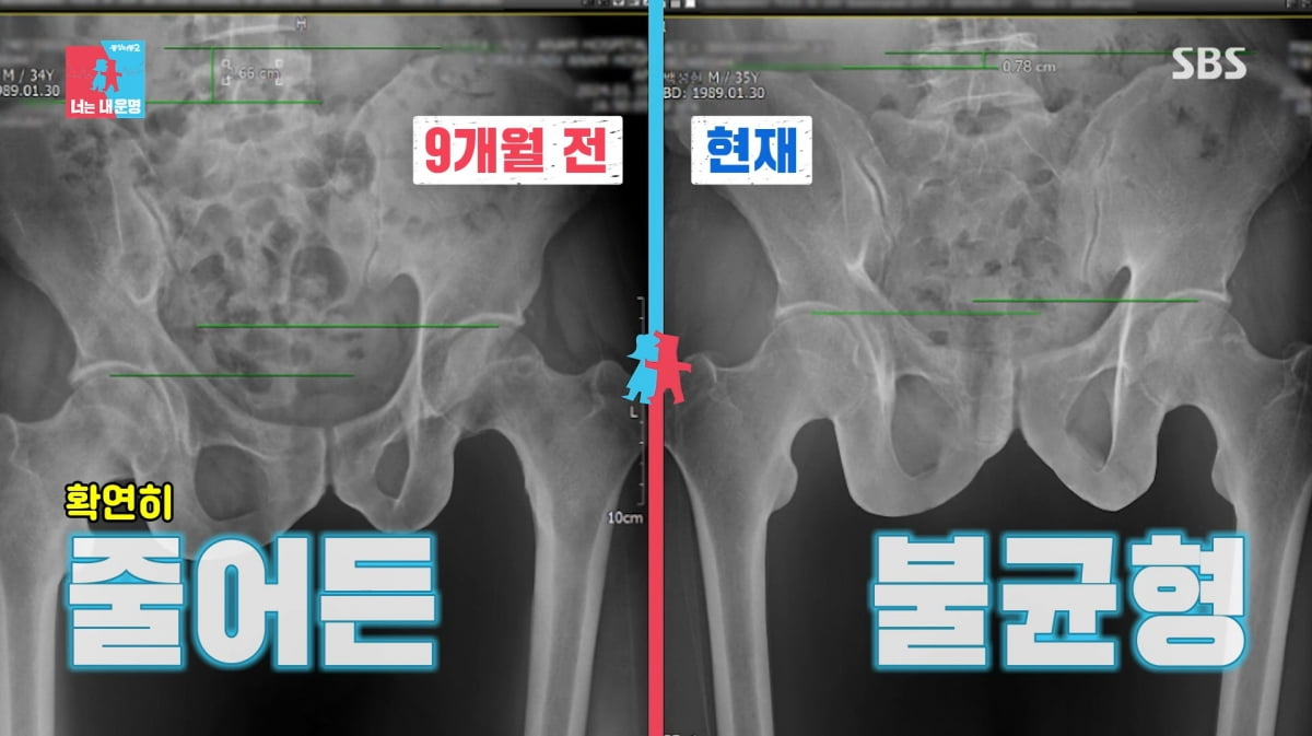 사진=SBS '동상이몽2'