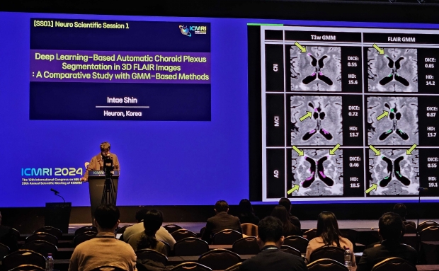 휴런, 2024 국제 MRI 학술대회 참가, 다수 발표 진행