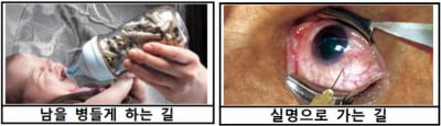 "담배, 실명으로 가는 길"…오늘부터 강력해지는 담뱃갑 그림