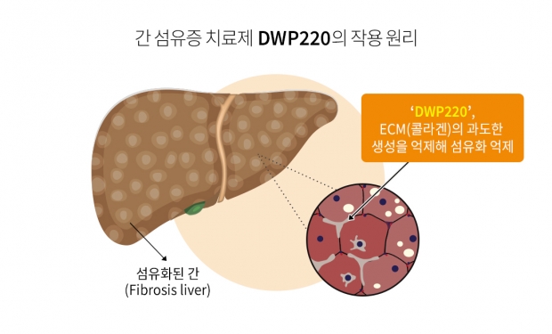 대웅제약, 중증 간 섬유증 ‘경구용 신약’ 세계 최초 개발 나선다