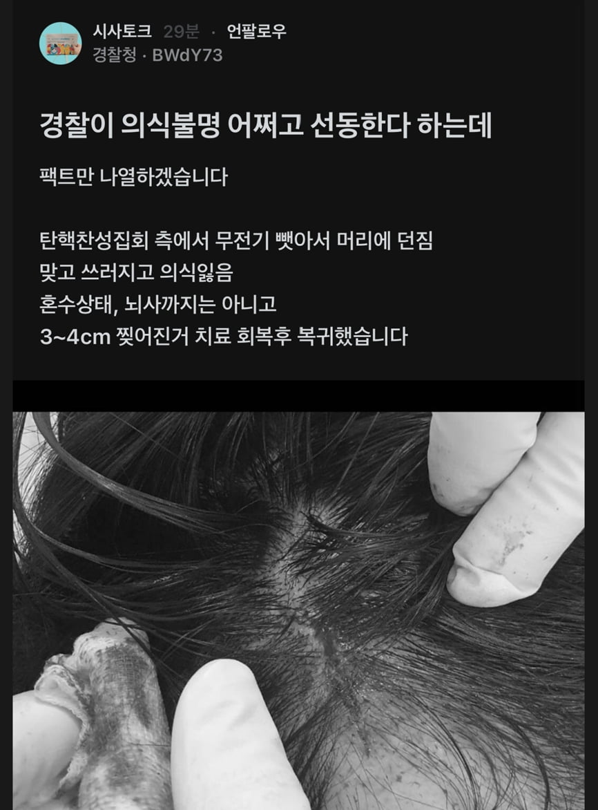 '블라인드'에 올라온 민노총 '무전기 폭행' 피해 경찰의 소식/ 사진=블라인드