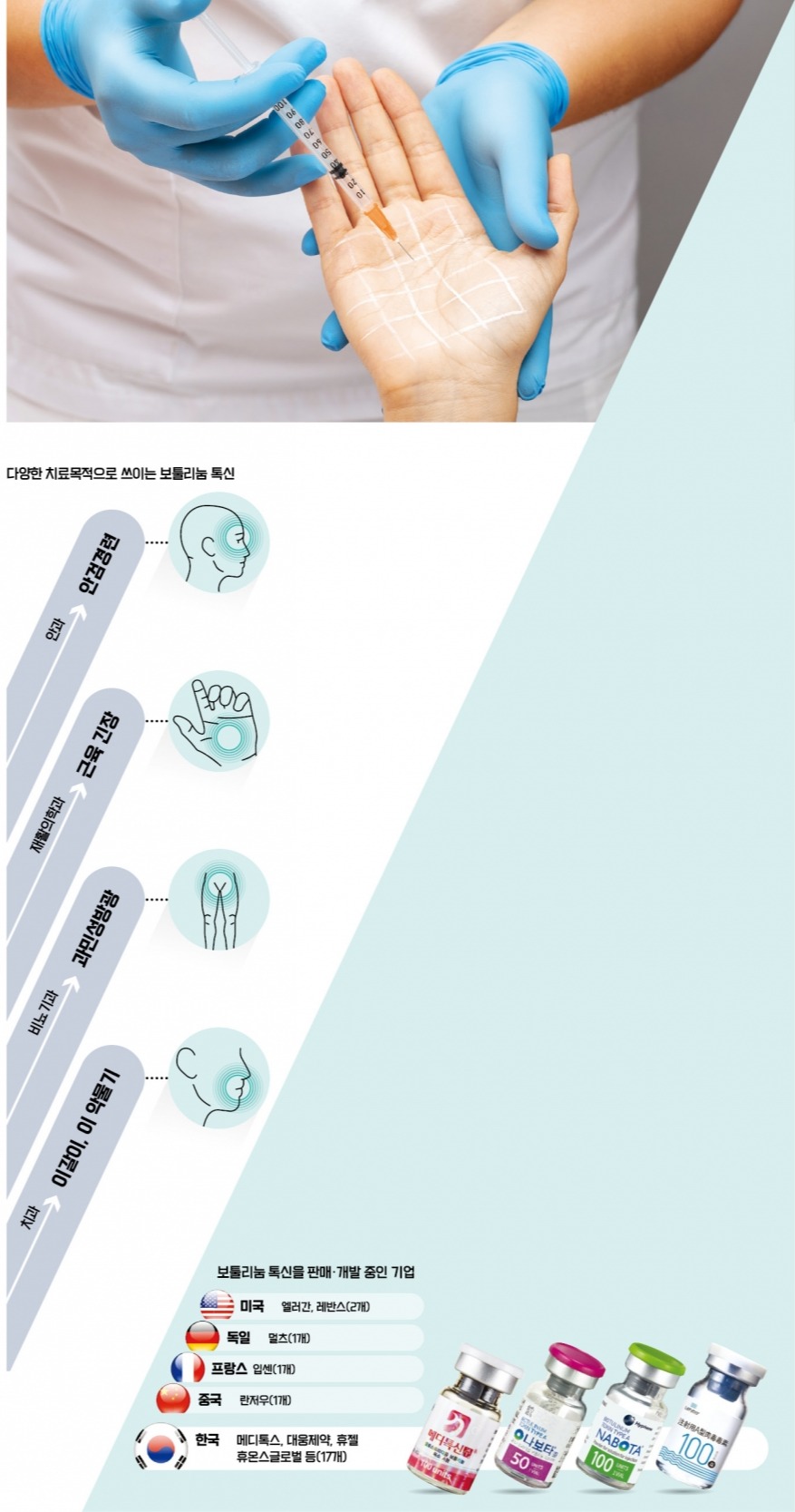 만성 두통·과민성 방광 시름 덜어준 보톡스…태생은 치료제였다