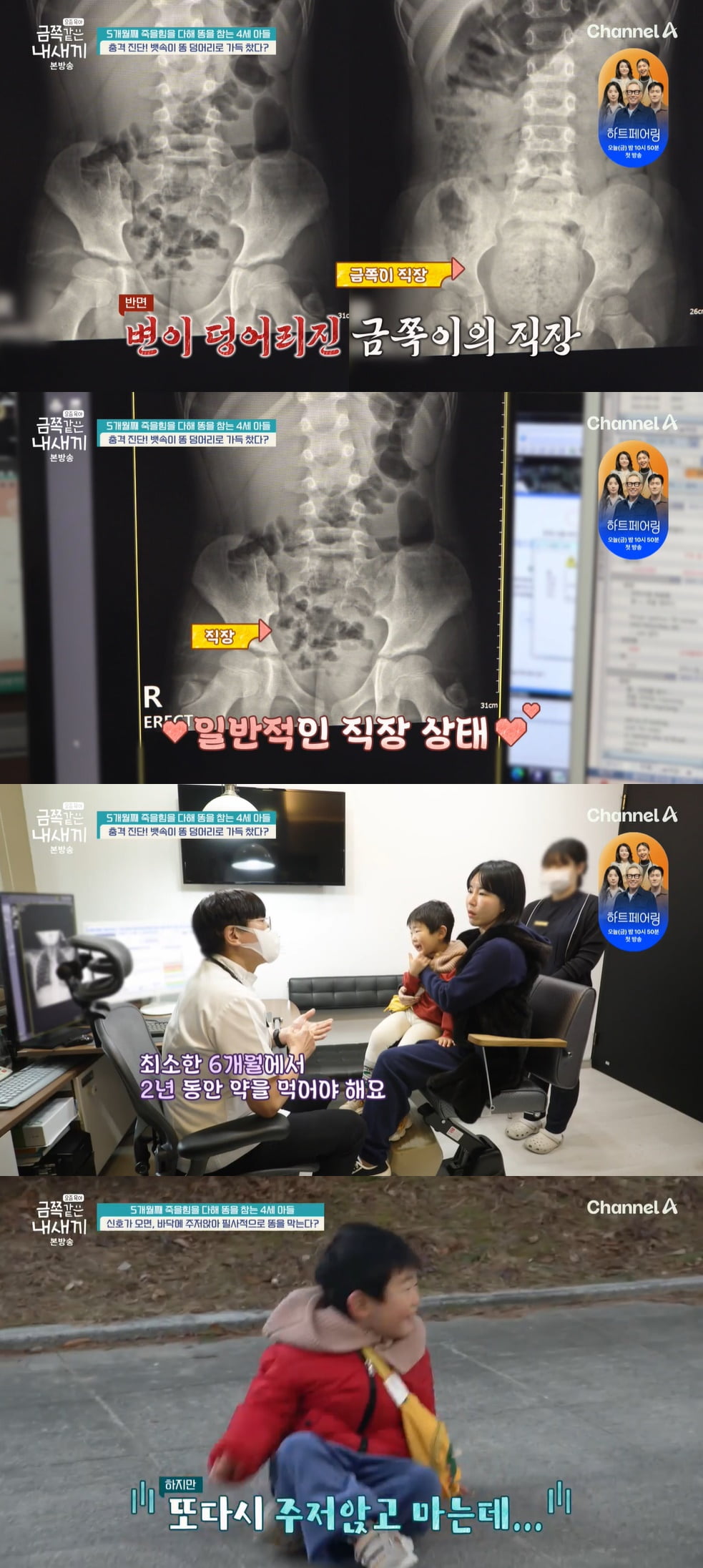 [종합]"5개월째 배변 거부" 4세 금쪽이, 대장→직장까지 단단한 변 가득..'심각' ('금쪽같은')