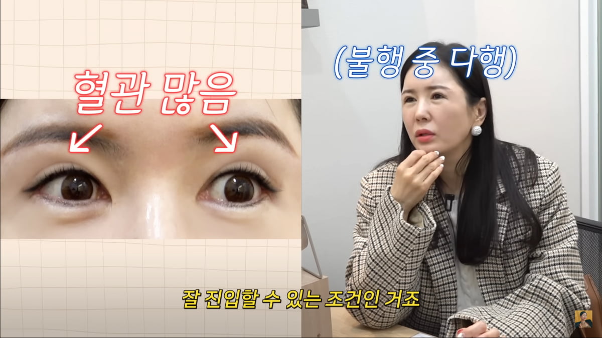 사진=유튜브 'A급 장영란' 영상 캡처