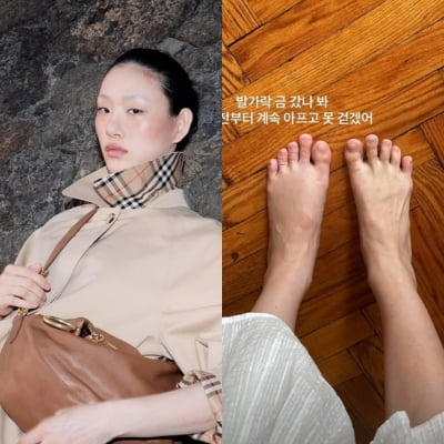 톱모델 최소라 "발가락 금 갔나봐 못 걷겠어"…뉴욕서 안타까운 근황