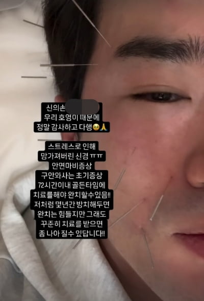 '26억 사기' 이민우, 안면마비+구안와사 고백 "골든타임 놓쳤다…완치 힘들어"
