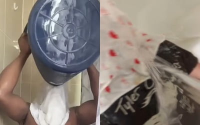 "따라하지 마세요"…'물 고문' 워터보딩 챌린지 '경악'