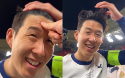 우승 트로피에 이마 긁힌 손흥민 "누가 밀어서 상처났어요"
