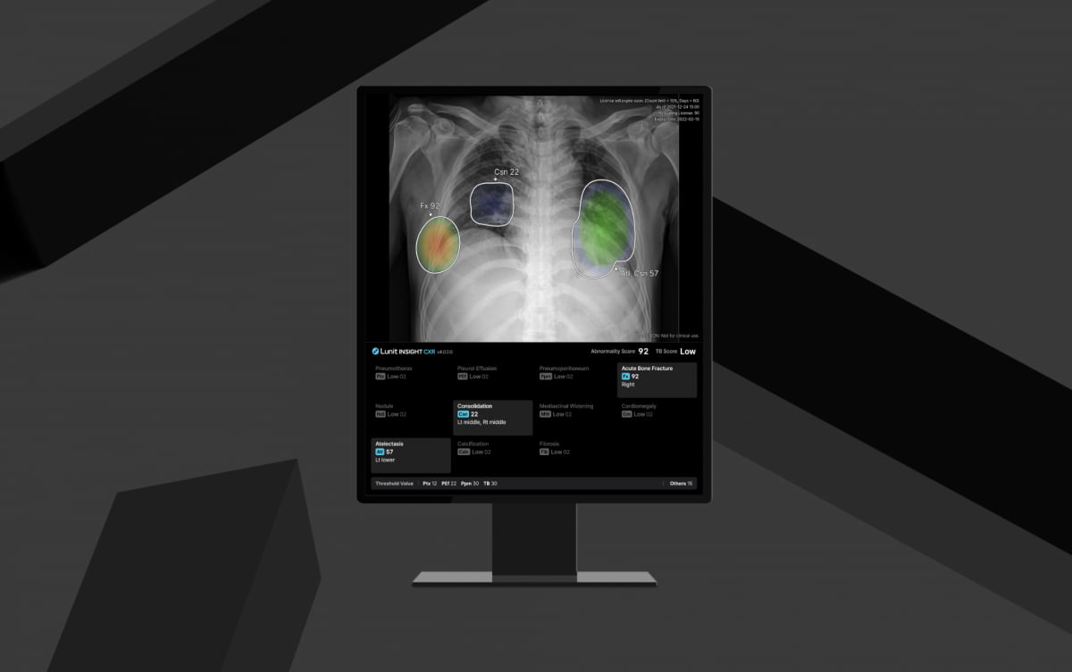 루닛이 만든 흉부 엑스레이 진단 AI 'CXR4', 유럽 CE MDR 인증 획득