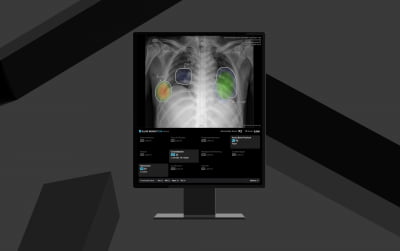 루닛이 만든 흉부 엑스레이 진단 AI 'CXR4', 유럽 CE MDR 인증 획득
