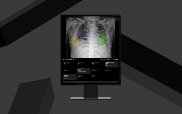 루닛, AI 흉부 엑스레이 진단 솔루션 'CXR4' 유럽 CE MDR 인증 획득