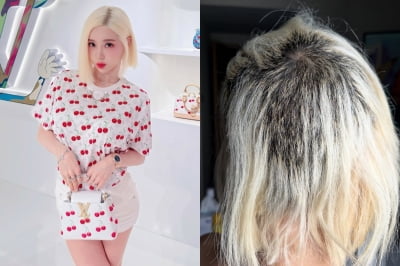 DJ소다, 탈색 후 머리 녹아내려…"500만원 줄테니 합의하자고"