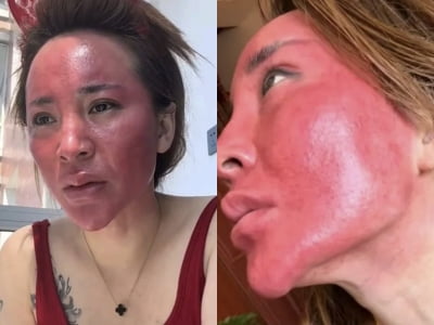 22년간 화장 지우지 않았더니…'이럴 수가'