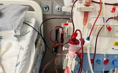 국산 혈액투석 필터, 수입산 뛰어넘는 성능 입증
