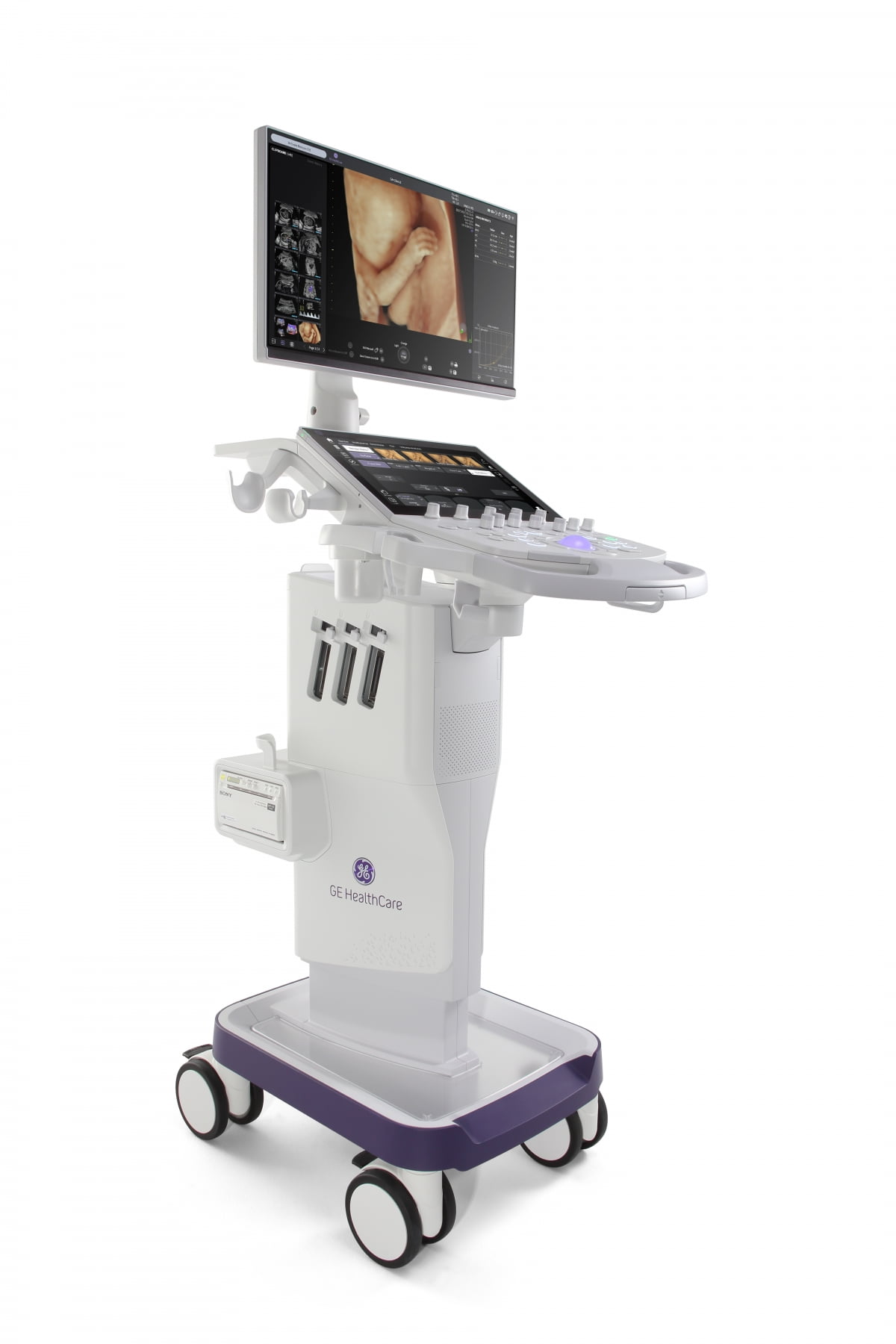 제품 설계서 생산까지 한국에서…GE헬스케어 초음파 신제품 출시