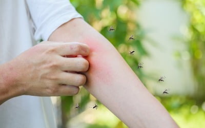 "장마 전후 매개 모기 증가"…질병청 '말라리아 주의보' 발령