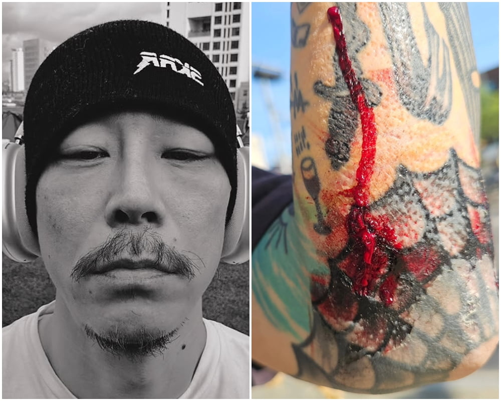 Rapper Bill Stax (Formerly Vasco) Suffers Motorcycle Accident