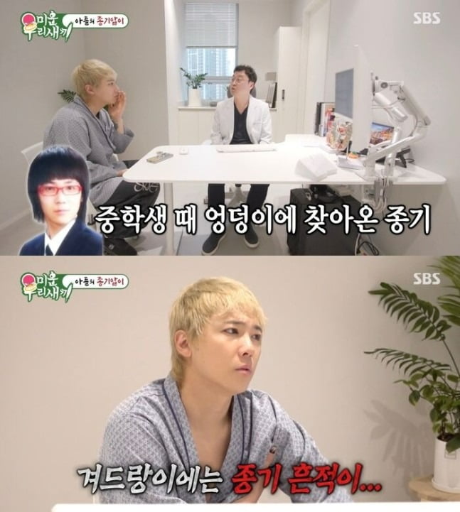 FT Island's Lee Hong-gi Opens Up About Battle with Rare Skin Condition