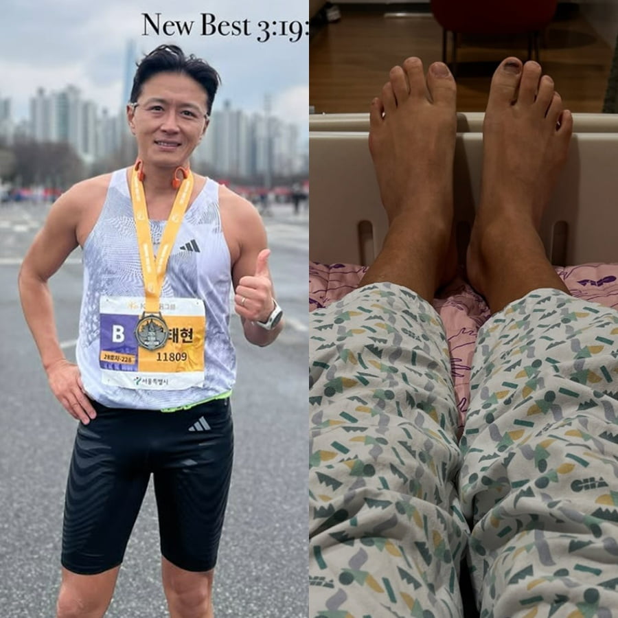 俳優ジン・テヒョン、甲状腺がん手術を無事に終了