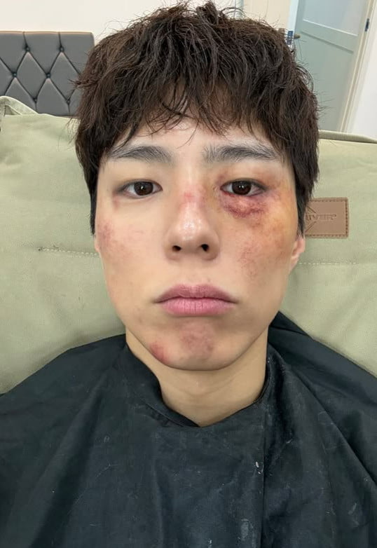 Park Bo-gum Shines with a Smile Despite Grueling Filming Conditions
