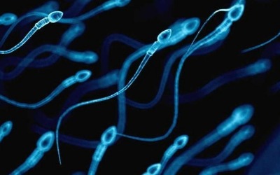 AI로 '무정자증' 남성 정자 찾아내…난임부부 18년 만에 임신 성공