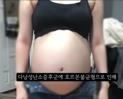 '임신 36주 낙태 수술' 병원 집도의·원장 구속 송치