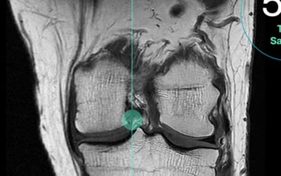 MRI 누워있는 시간 확 줄인다…美 AI 의료영상社 투자 유치