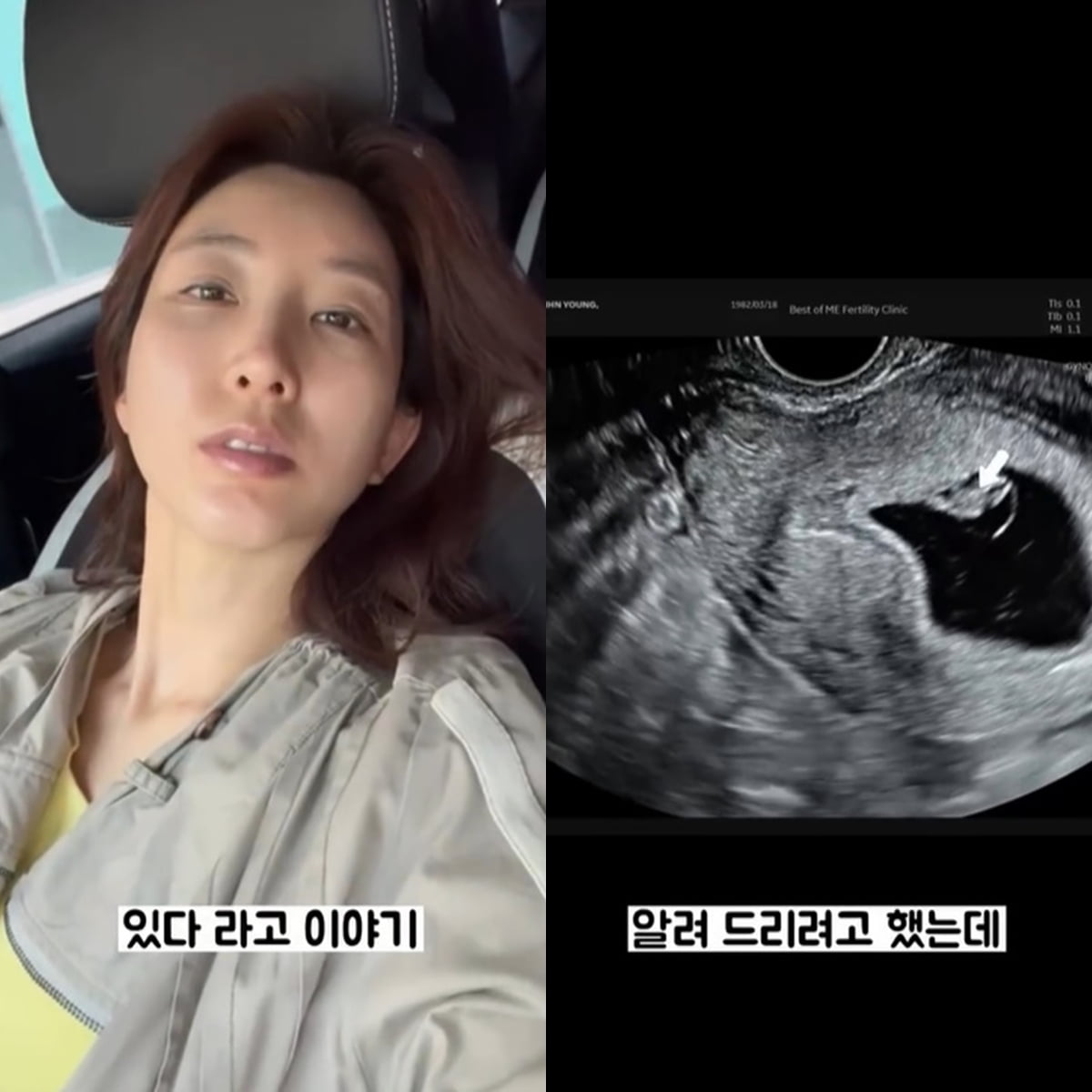 Actress Park In-young Opens Up About Miscarriage, Receives Support from Fans