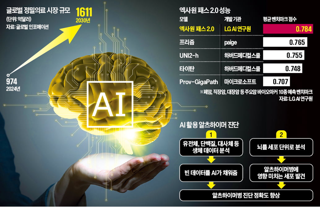 LG AI로 알츠하이머 '족집게 진단' … 정확도 92%로 높여
