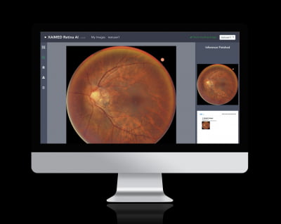 [보건산업혁신창업센터 유망기업, 혁신 DNA 미래를 설계하다] 자이메드, 안저기반 동맥경화 AI 솔루션 신의료기술 평가 유예 선정