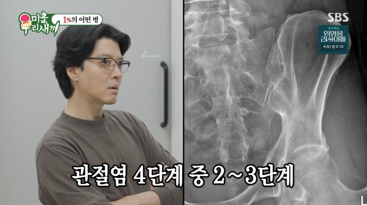 Lee Dong-gun Diagnosed with Rare Genetic Disease on 'My Ugly Duckling'